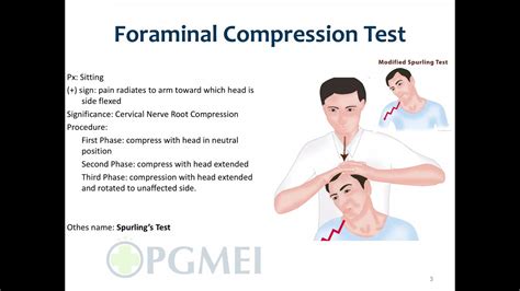 jack sons compression test|jackson compression test vs spurling's.